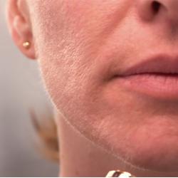 Dispozitiv pentru indepartarea parului facial Wellneo Flawless + Masca fata CADOU Dispozitiv pentru indepartarea parului facial Wellneo Flawless + Masca fata CADOU