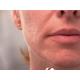 Dispozitiv pentru indepartarea parului facial Wellneo Flawless + Masca fata CADOU Dispozitiv pentru indepartarea parului facial Wellneo Flawless + Masca fata CADOU