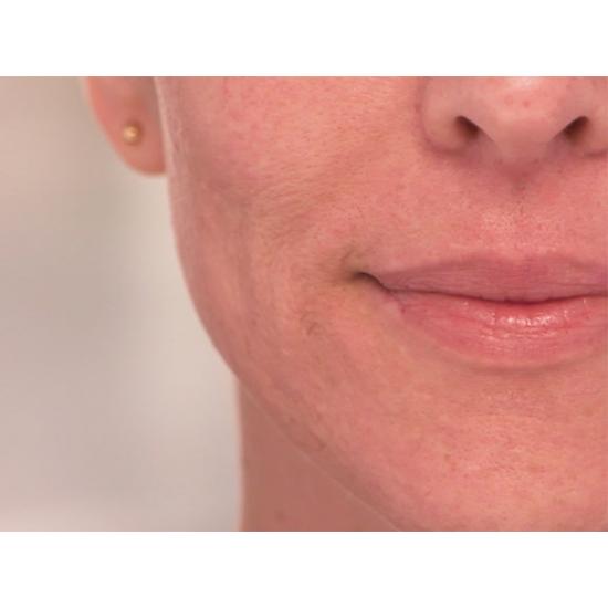 Dispozitiv pentru indepartarea parului facial Wellneo Flawless + Masca fata CADOU Dispozitiv pentru indepartarea parului facial Wellneo Flawless + Masca fata CADOU