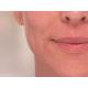 Dispozitiv pentru indepartarea parului facial Wellneo Flawless + Masca fata CADOU Dispozitiv pentru indepartarea parului facial Wellneo Flawless + Masca fata CADOU